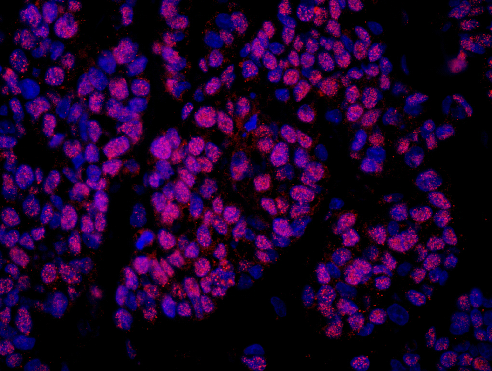 Rabbit anti-COBRA1 IHC Antibody