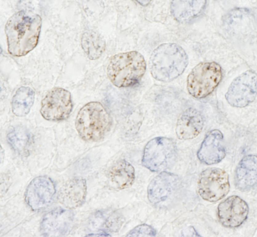 Rabbit anti-HDAC7 IHC Antibody