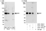 Detection of human ABI1 by western blot and immunoprecipitation.
