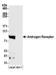 Detection of human Androgen Receptor by western blot.