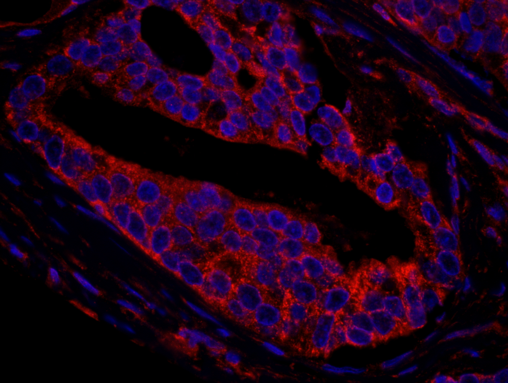 Rabbit anti-CNOT3 IHC Antibody