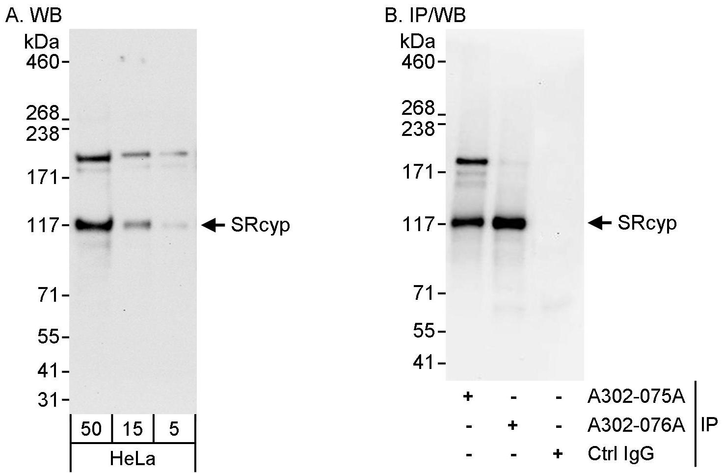 Detection of human SRcyp by western blot and immunoprecipitation.