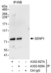 Detection of human SENP1 by western blot of immunoprecipitates.