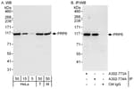Detection of human and mouse PRP6 by western blot (h&amp;m) and immunoprecipitation (h).