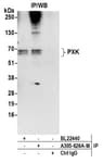 Detection of human PXK by western blot of immunoprecipitates.