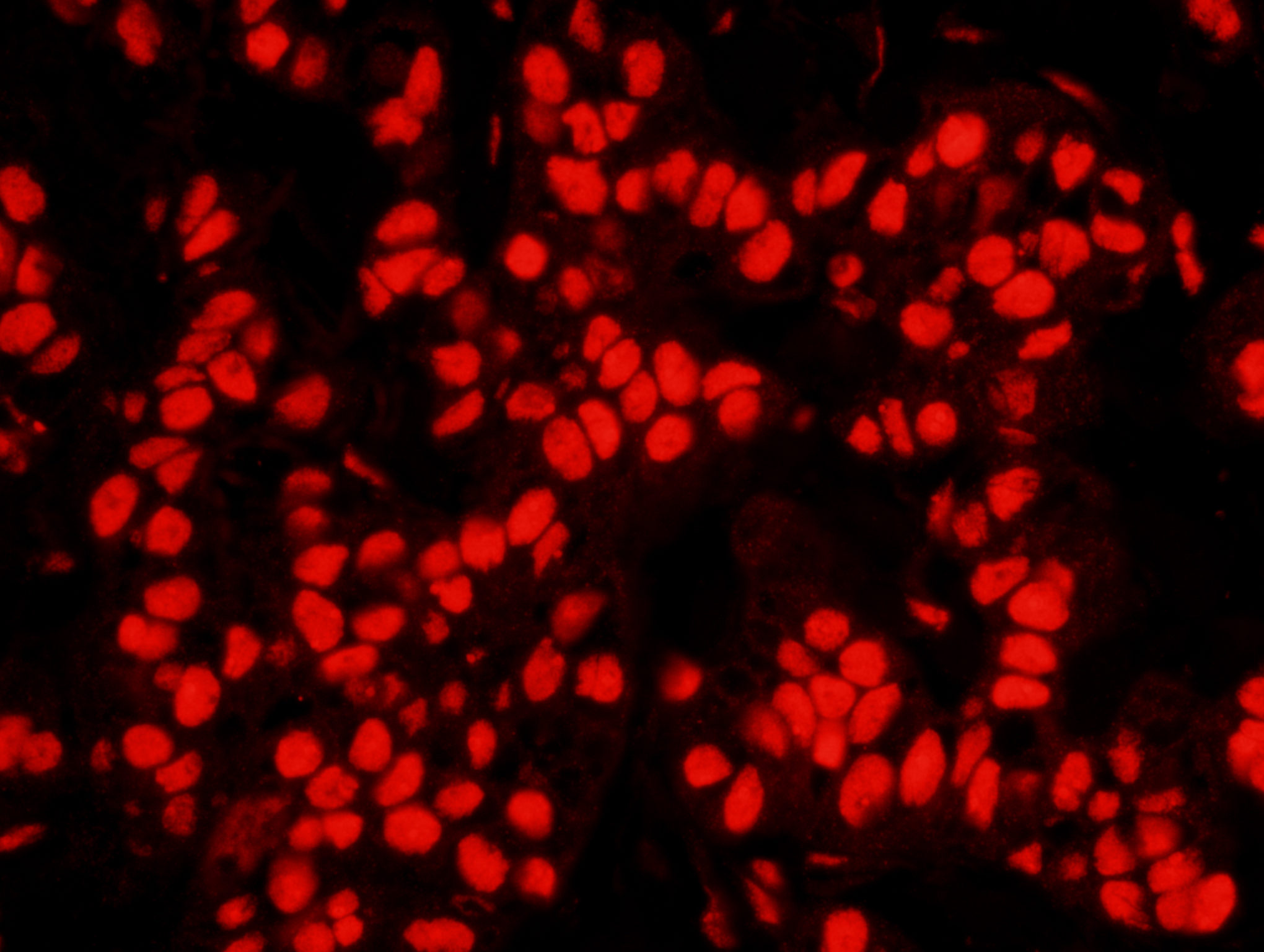 Rabbit anti-NPM1 IHC Antibody