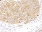 Detection of mouse SHMT1 by immunohistochemistry.