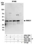 Detection of human MMS21 by western blot of immunoprecipitates.