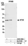 Detection of human STX5 by western blot of immunoprecipitates.