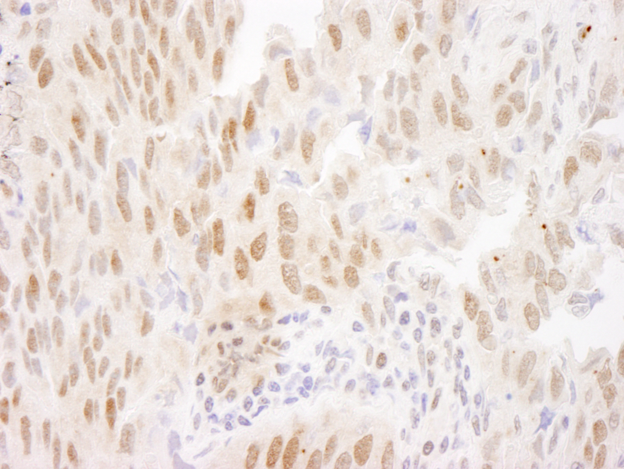 Rabbit anti-FOXO3a IHC Antibody