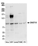 Detection of human and mouse CNOT10 by western blot.