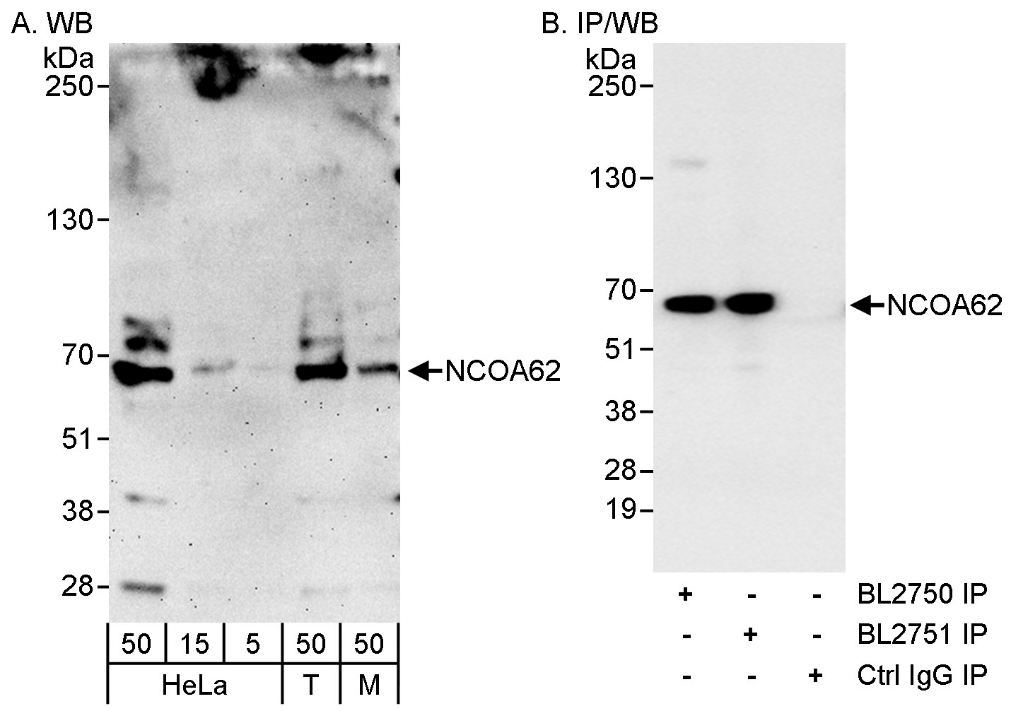 Detection of human and mouse NCOA62 by western blot and immunoprecipitation.