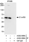 Detection of human C1orf55 by western blot of immunoprecipitates.
