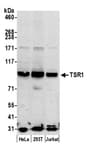 Detection of human TSR1 by western blot.