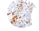 Detection of human CTNND1/p120 Catenin by immunohistochemistry.