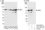 Detection of human and mouse IMP3 by western blot (h and m) and immunoprecipitation (h).
