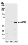 Detection of human AMPD3 by western blot.