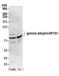 Detection of mouse gamma Adaptin/AP1G1 by western blot.