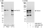 Detection of human TACC3 by western blot and immunoprecipitation.