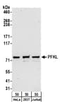 Detection of human PFKL by western blot.