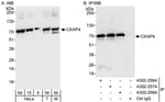 Detection of human and mouse CKAP4 by western blot (h&amp;m) and immunoprecipitation (h).