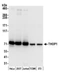 Detection of human and mouse THOP1 by western blot.