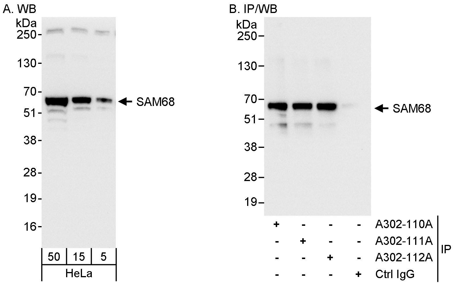 Detection of human SAM68 by western blot and immunoprecipitation.