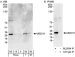 Detection of human and mouse MED18 by western blot (h&amp;m) and immunoprecipitation (h).