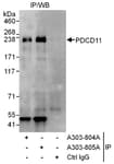 Detection of human PDCD11 by western blot of immunoprecipitates.