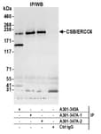 Detection of human CSB/ERCC6 by western blot of immunoprecipitates.