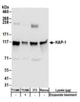 Detection of mouse KAP-1 by western blot.