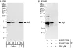 Detection of human AIF by western blot and immunoprecipitation.