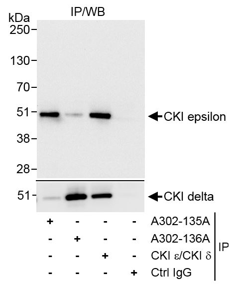 Detection of human CKI epsilon by western blot of immunoprecipitates.