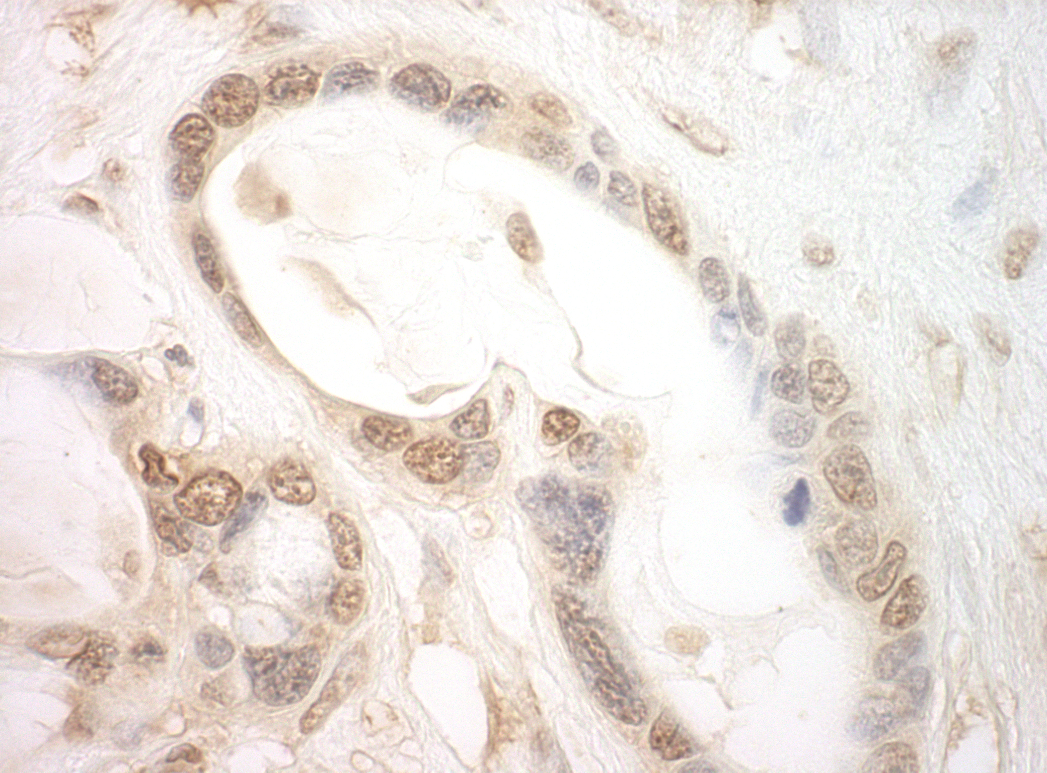 Detection of human eIF2B5 by immunohistochemistry.