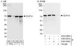 Detection of human DCP1A by western blot and immunoprecipitation.