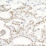 Detection of human BRD3 by immunohistochemistry.