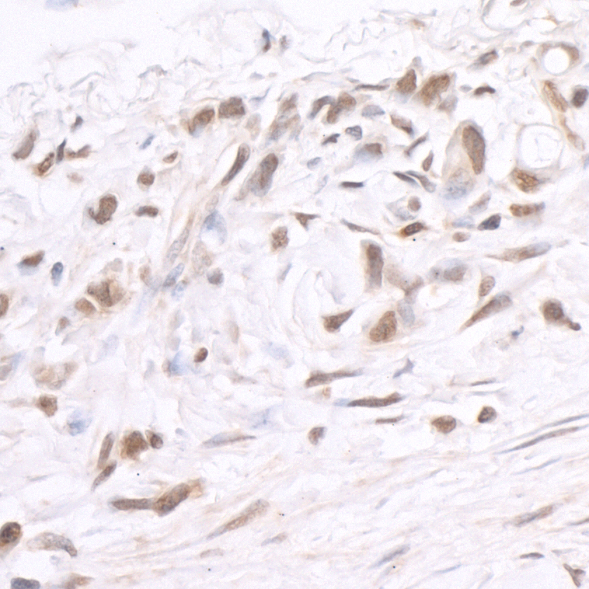 Rabbit anti-BRD2 IHC Antibody