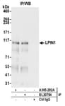 Detection of human LPIN1 by western blot of immunoprecipitates.