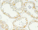 Detection of human Inhibin Alpha by immunohistochemistry.
