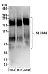 Detection of human SLC9A6 by western blot.