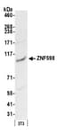 Detection of mouse ZNF598 by western blot.