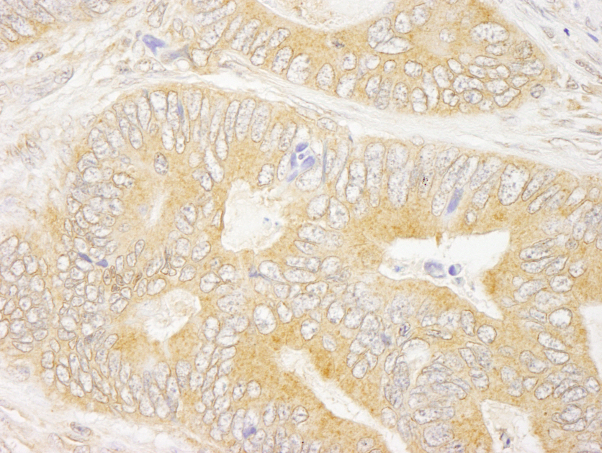 Rabbit anti-GRB10 IHC Antibody