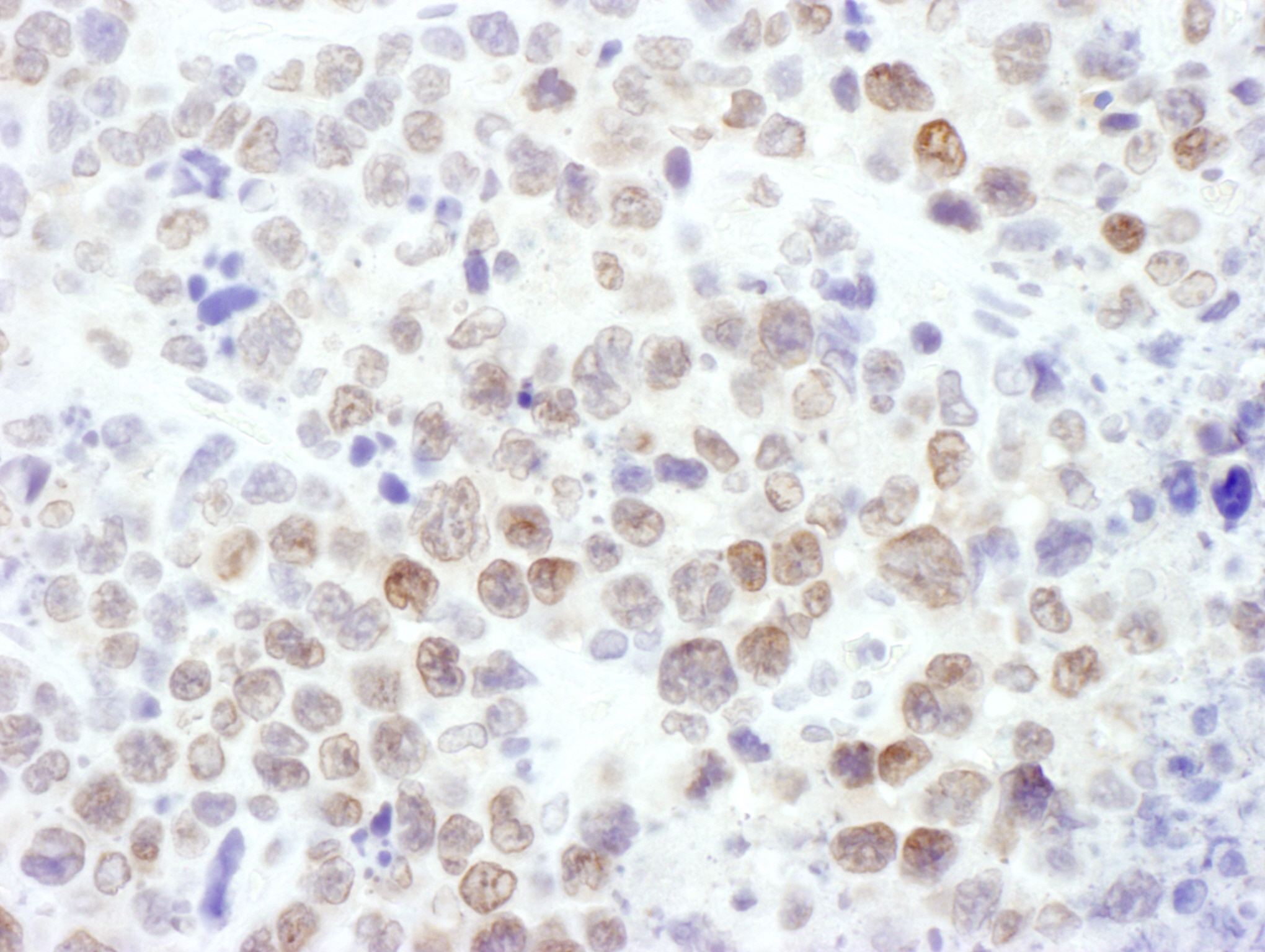 Detection of mouse EZH2 by immunohistochemistry.