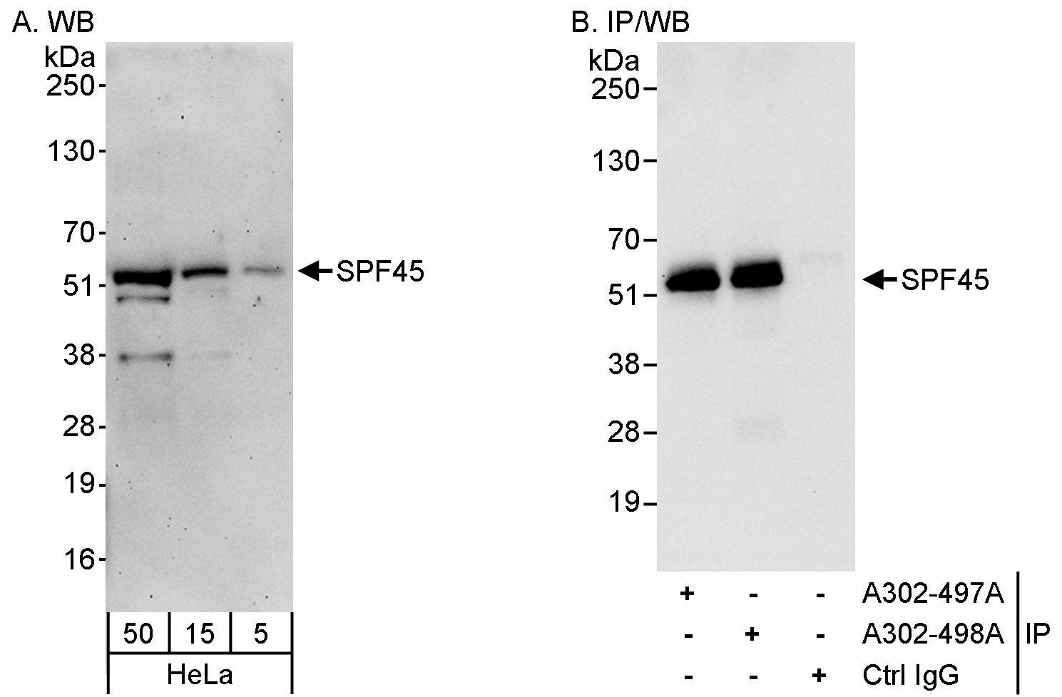 Detection of human SPF45 by western blot and immunoprecipitation.