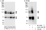 Detection of human MAP7D1 by western blot and immunoprecipitation.