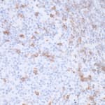 Detection of human PD-1 in FFPE hodgkin&#39;s lymphoma by IHC.
