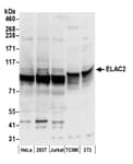 Detection of human and mouse ELAC2 by western blot.