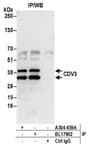 Detection of human CDV3 by western blot of immunoprecipitates.
