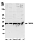 Detection of human and mouse CAPZB by western blot.