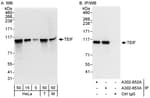 Detection of human and mouse TEIF by western blot (h&amp;m) and immunoprecipitation (h).